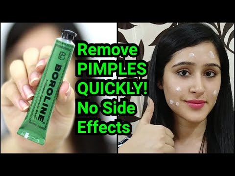 Remove PIMPLES & ACNE IN 3 DAYS | NATURAL & EASY METHOD