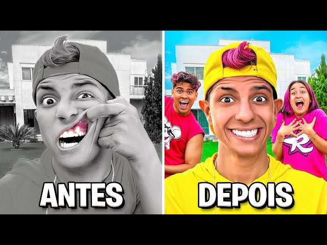FIM DO MEU DENTE TORTO … *Fiz a cirurgia ?