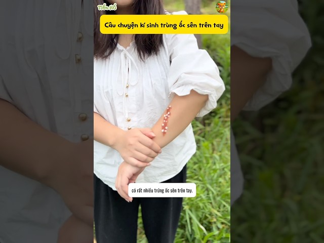 Câu chuyện kí sinh trùng vỏ ốc sên #shorts