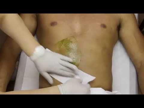 Male Stomach Hair Removal New York.Stomach Waxing For Men in NYC (Azulene)