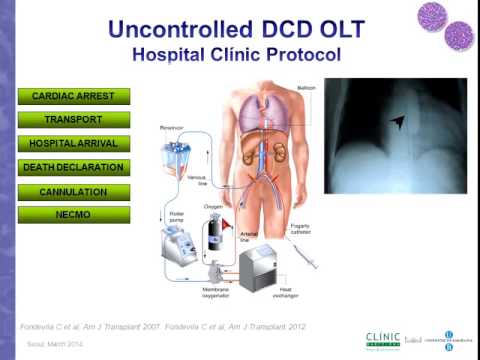 Preservation of DCD grafts: increasing the efficacy 