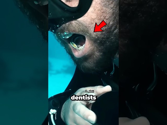 ليش لازم تفتح فمك إذا شفت هذي السمكة؟👄🐟