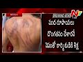 Worker brutally beaten by owner in Tirumala