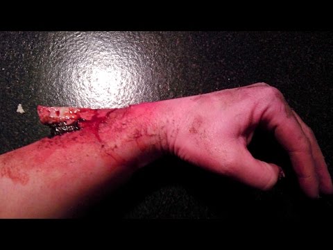 Жестоко: Кршење рака на улица