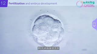 Step for performing IVF 试管婴儿的步骤