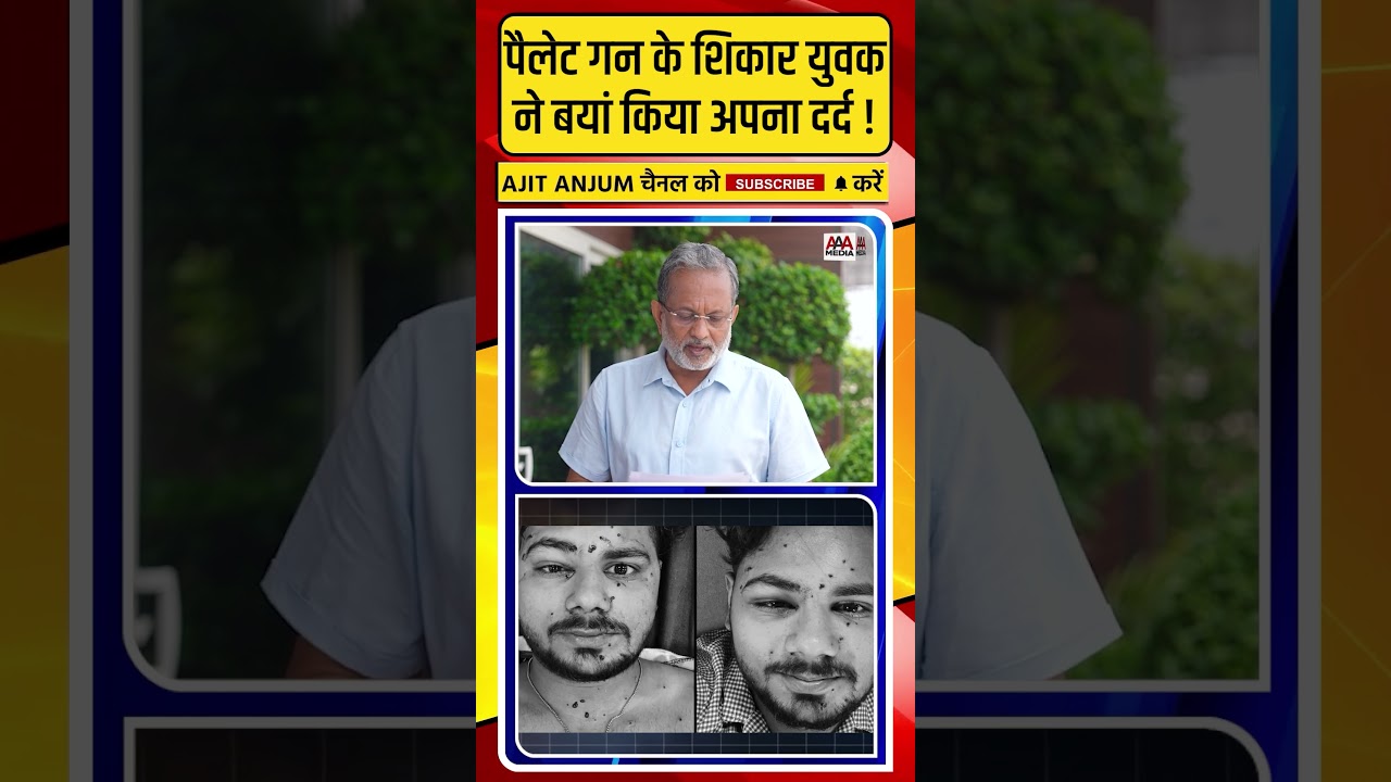 CJP Protest में पैलेट गन के शिकार युवक ने बयां किया अपना दर्द !