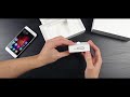 Xiaomi Mi5S спустя ПОЛГОДА использования! Честный, детальный обзор! Плюсы и Минусы! Отзыв