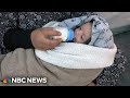 Palestinian baby Anas gets sunshine therapy at camp in Rafah, Gaza