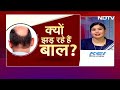 Hair Fall के पीछे Covid-19 का हाथ? | Hair Transplant | NDTV India - 13:44 min - News - Video