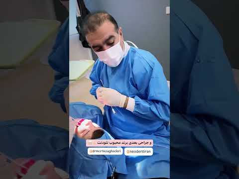 dental implant 