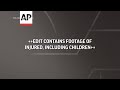 Atienden a decenas de heridos en Jan Yunis tras ofensiva de Israel