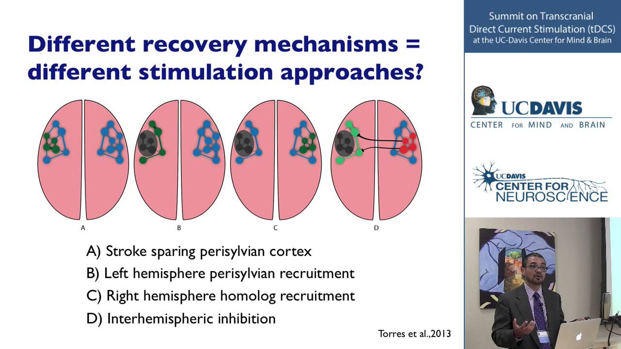 clinical-applications-of-transcranial-direct-current-stimulation-youtube