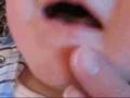 Matt's first tooth broke through!