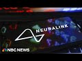 This is a revolution: Doctor discusses Neuralink brain interface impact on paralysis