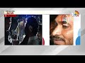 LIVE : సీఎం జగన్‌ కనుబొమ్మకు తాకిన రాయి | Stone Pelted On CM Jagan | Bus Yatra | Vijayawada | 10TV  - 02:38:06 min - News - Video