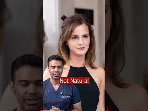 Hollywood's Secret: Natural or Expertly Enhanced?