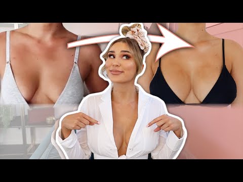 My Personal Boob Job Story | 2 Years Later!