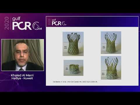 Transcatheter valve-in-valve procedure – Making tomorrow, today - GulfPCR-GIM 2020