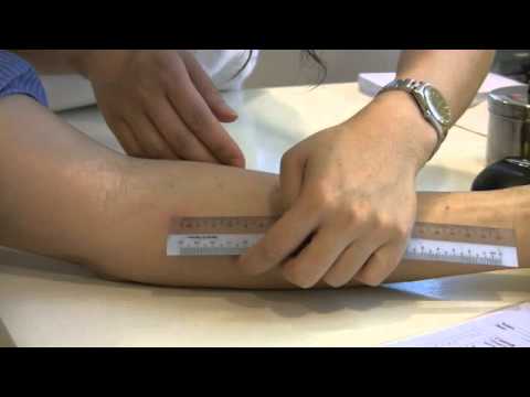 Allergy test, allergy and asthma Care Hong Kong, 過敏測試