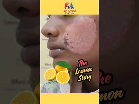 ನಿಂಬೆ ಹಣ್ಣಿನ ರಸ ಮನೆಮದ್ದು ಹೌದು, ಆದರೆ ಸರಿಯಾದ ರೀತಿಯಲ್ಲಿ ಬಳಸಿಲ್ಲ ಅಂದ್ರೆ, ಏನಾಗುತ್ತೋ ನೋಡಿ..! #lemon #face