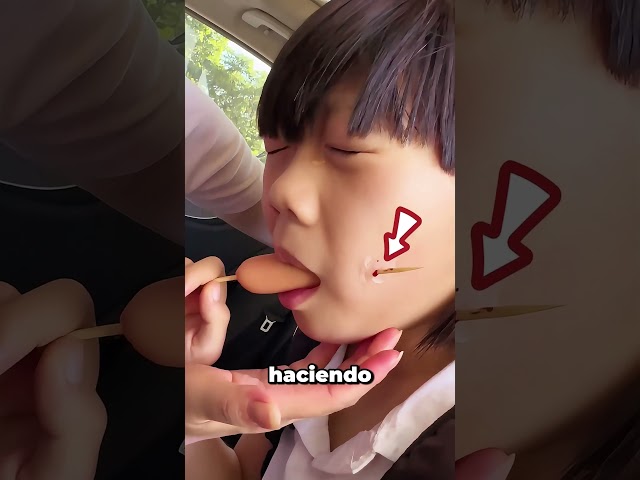 Él Fingió Tener Dolor Con Un Sticker Falso De Palillo 😳