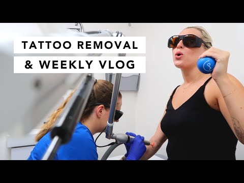 Tattoo Removal Weekly Vlog | Estée Lalonde