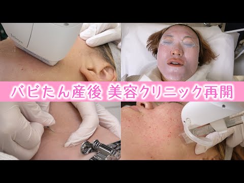 バビたん産後久しぶりに美容クリニック再開したよん！