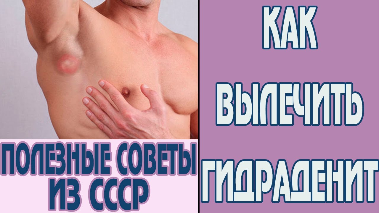 Под Мышкой Появилась Шишка Фото