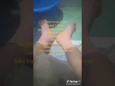 maaf dalam perawatan luka bakar tingkat 2🙏#kreatoryoutube #kenamusibah di#lukabakar