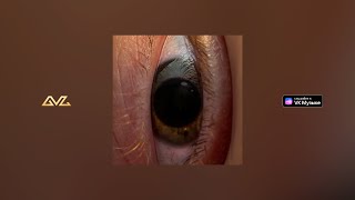 Минаева — Шоколадка (Regions Remix)