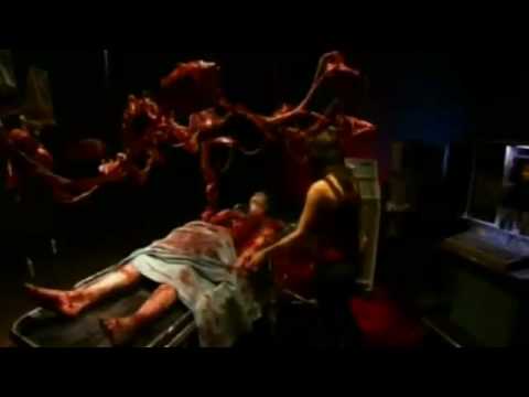 Autopsy'