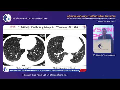 1. Tiếp cận thực hành CĐHA bệnh phổi mô kẽ (TS. Nguyễn Trường Giang)