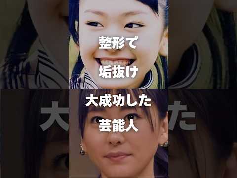 整形で垢抜けた有名人のビフォーアフターと成功の秘訣 サムネイル