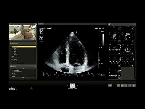 Chuẩn hóa siêu âm tim theo các khuyến cáo hiện hành - Thực hành (PGS.TS.BS. Lê Minh Khôi)