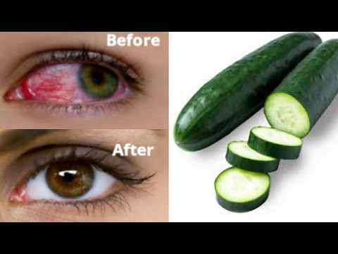 How to remove bad eye sight naturally in 3 days how to correct bad eye sight fast