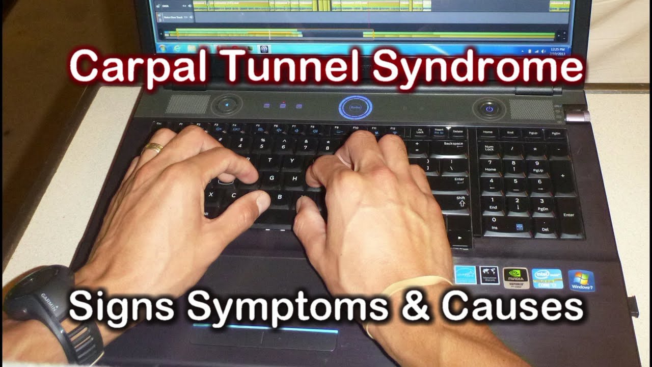 Carpal Tunnel Signs Symptoms & Causes of Carpal Tunnel Syndrome - YouTube