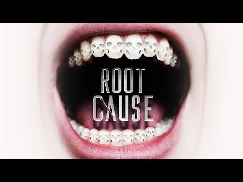 Root Cause'