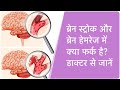 Ischemic vs Hemorrhagic (in Hindi)| ब्रेन स्ट्रोक और ब्रेन हैमरेज में क्या फर्क है? डॉक्‍टर से जानें