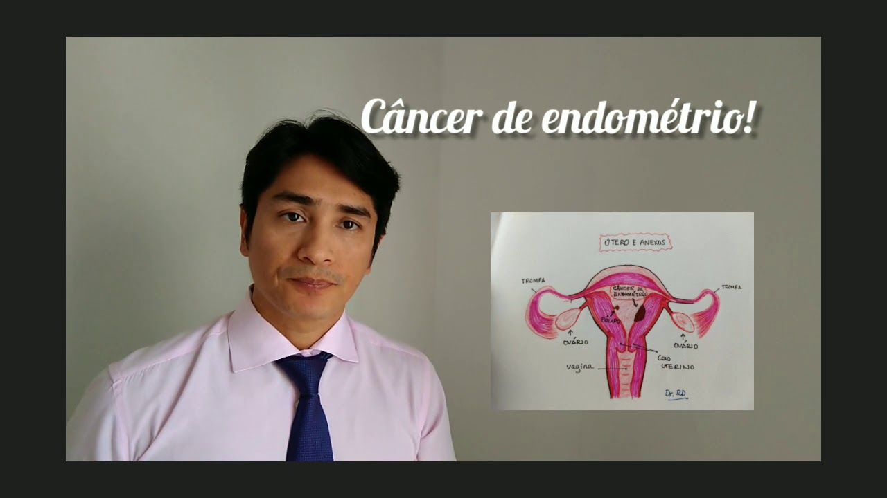 Cancer de endometrio esperanza de vida