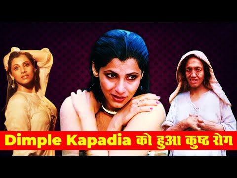 Dimple Kapadia is suffering from Leprosy | Leprosy Disease | Dimple Kapadia Leprosy | Dimple