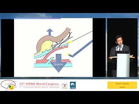 SYM13.1 Innovations in HPB Surgery