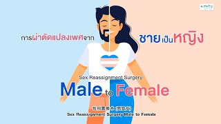 Sex Reassignment Surgery Male to Female