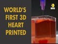 Watch: World's first 3D Heart printed in Israel