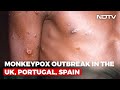 Explained: What Is Monkeypox And Why Cases Are Rising In Europe
