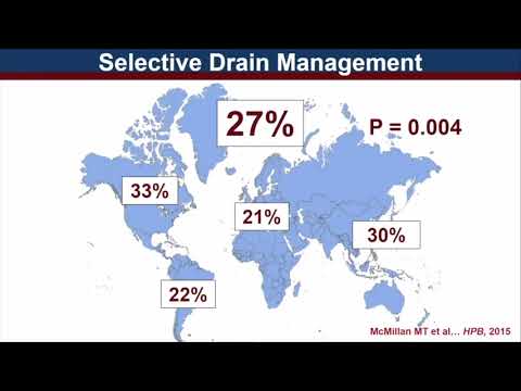 US11: Drain Management after Pancreatectomy