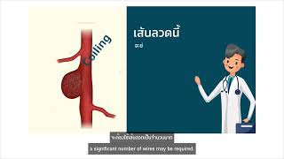 How to treat Cerebral Aneurysm