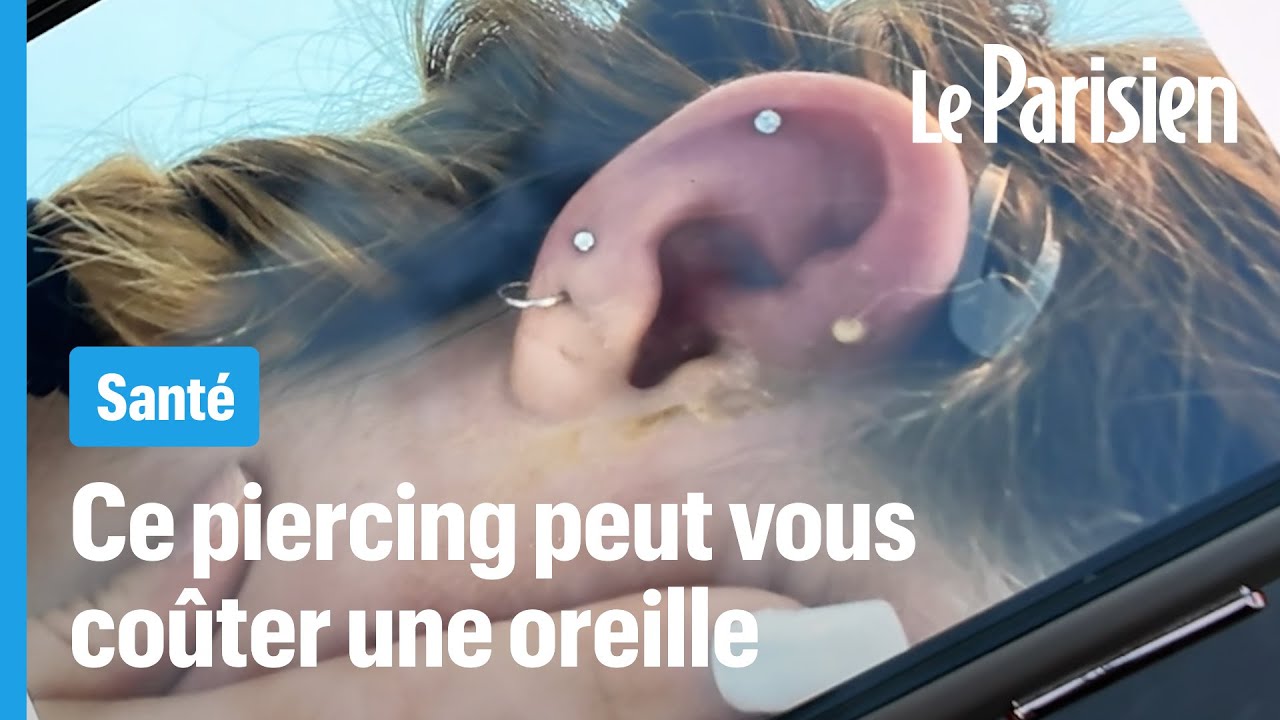 « J’ai perdu un bout d'oreille » : les dangers méconnus des piercings au cartilage