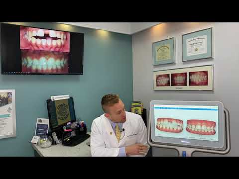 Orthodontist in West Palm Beach, FL - Lunsford McCaffrey Orthodontics