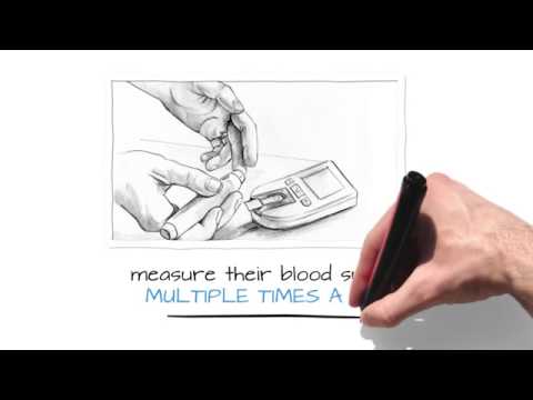 Watch a short video to learn more about Insulin Algorithms software. Watch a short video to learn more about Insulin Algorithms software.
