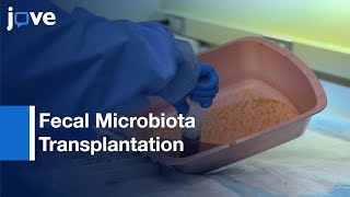 Fecal Microbiota Transplantation via Colonoscopy | Protocol Preiew